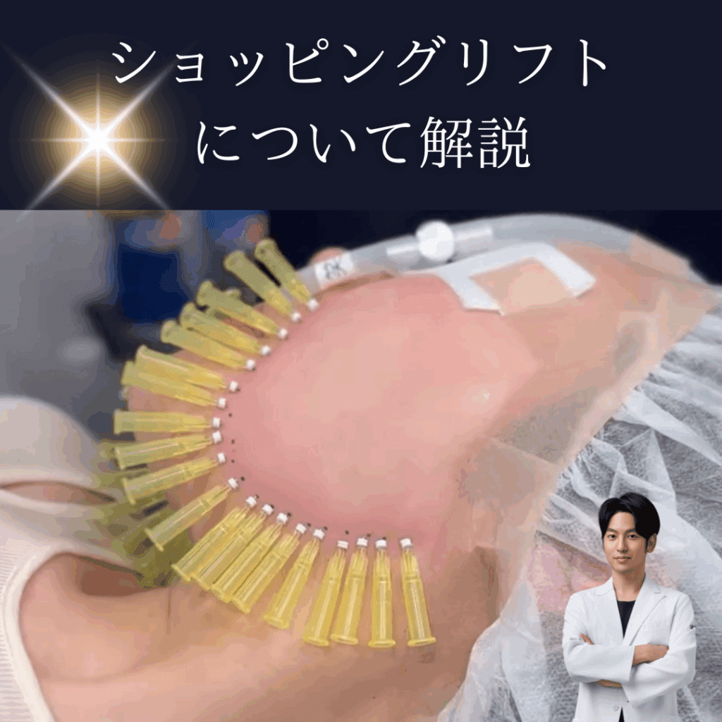 肌の引き締めにショッピングリフト！効果は？糸リフトやボルニューマと併用は？