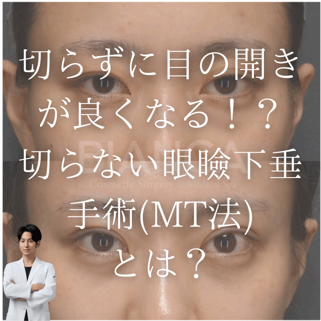 目の開きをよくする、”切らない眼瞼下垂手術(MT法)”とは？