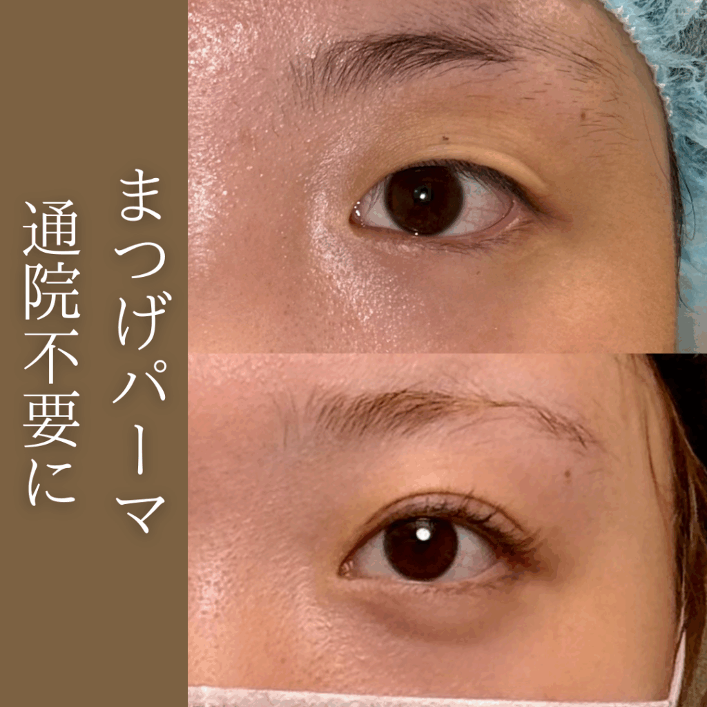 脱睫毛パーマ、ケアなしで睫毛パッチリ目元へ