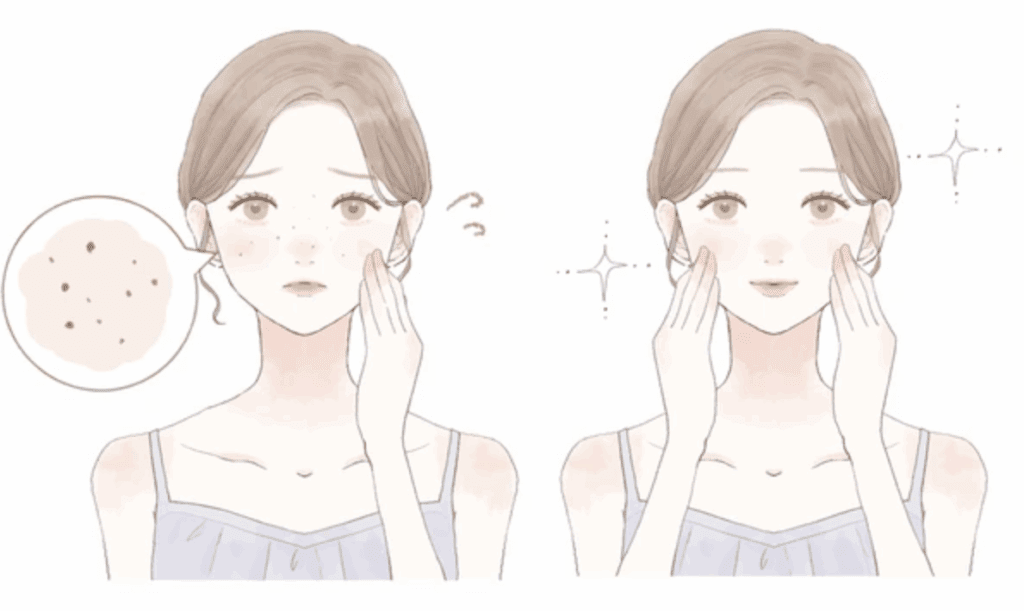 毛穴開大には原因に合った治療選択を