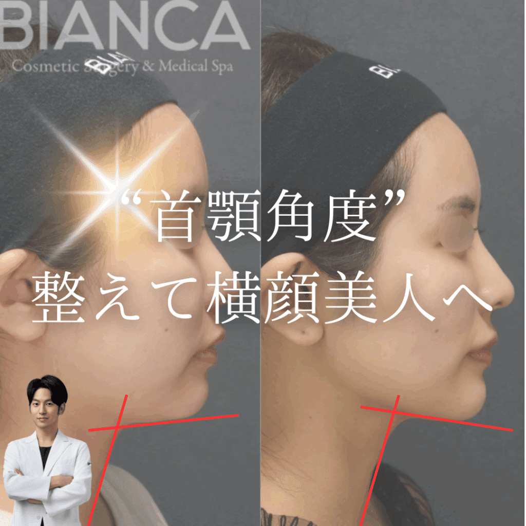 E-Lineだけじゃない！横顔美人の条件”首顎角度”とは？