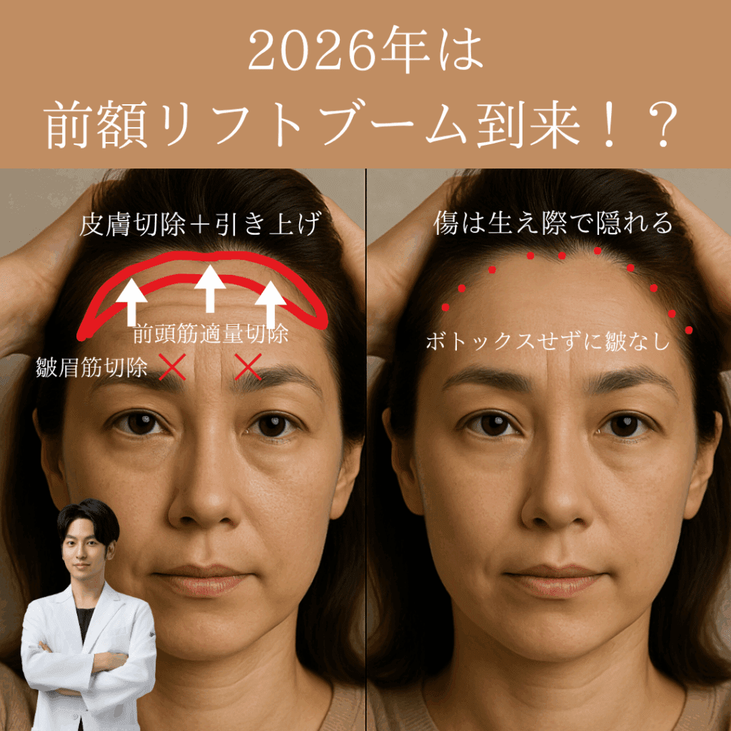 2026年は前額リフトブームが到来！？