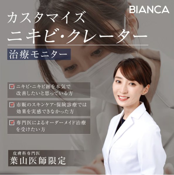 ニキビ・クレーターカスタマイズ治療始動中！