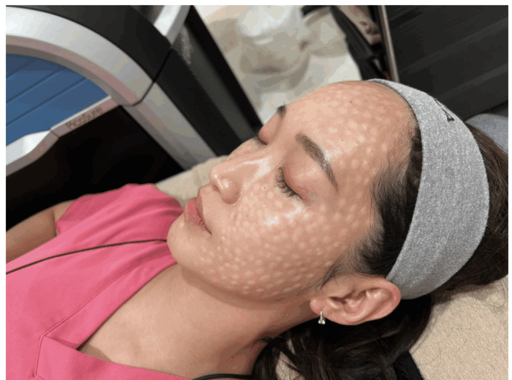 BIANCAイチオシ！「ハイドロブースト」とは？他の肌育製材と比較して説明します