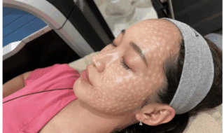 BIANCAイチオシ！「ハイドロブースト」とは？他の肌育製材と比較して説明します