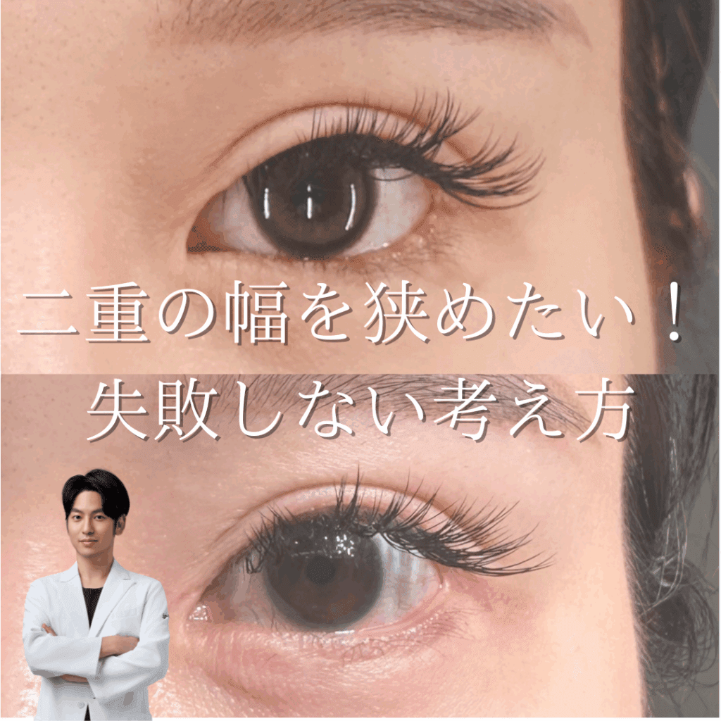 二重の幅を狭めたい！失敗しないために二重整形の考え方を学ぼう