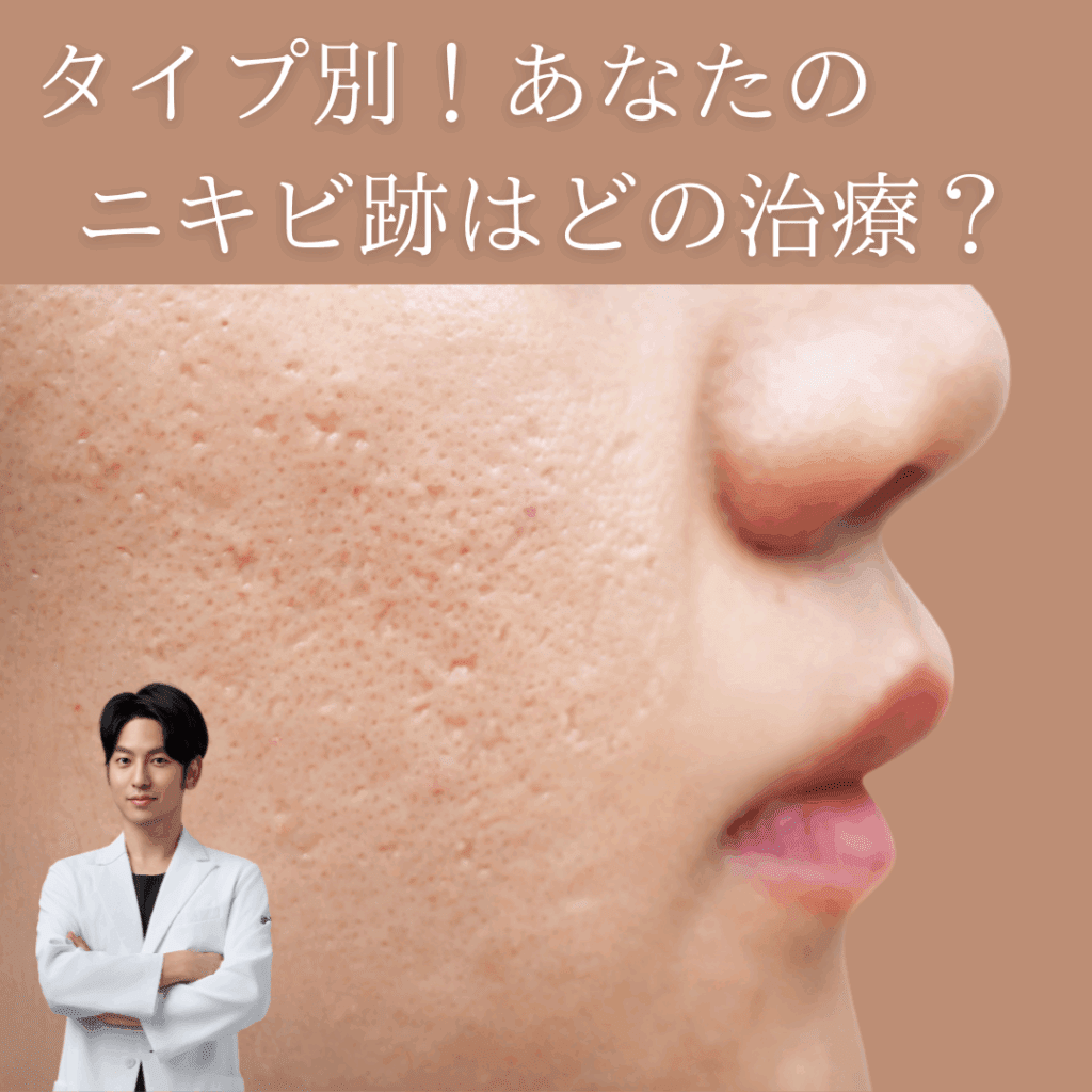 タイプ別！あなたのニキビ跡はどの治療法？