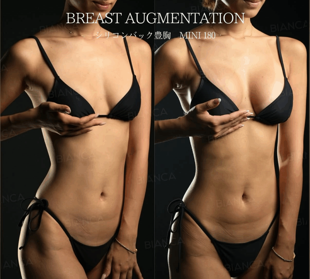 南医師限定✨7月小顔フルカスタムキャンペーン💗