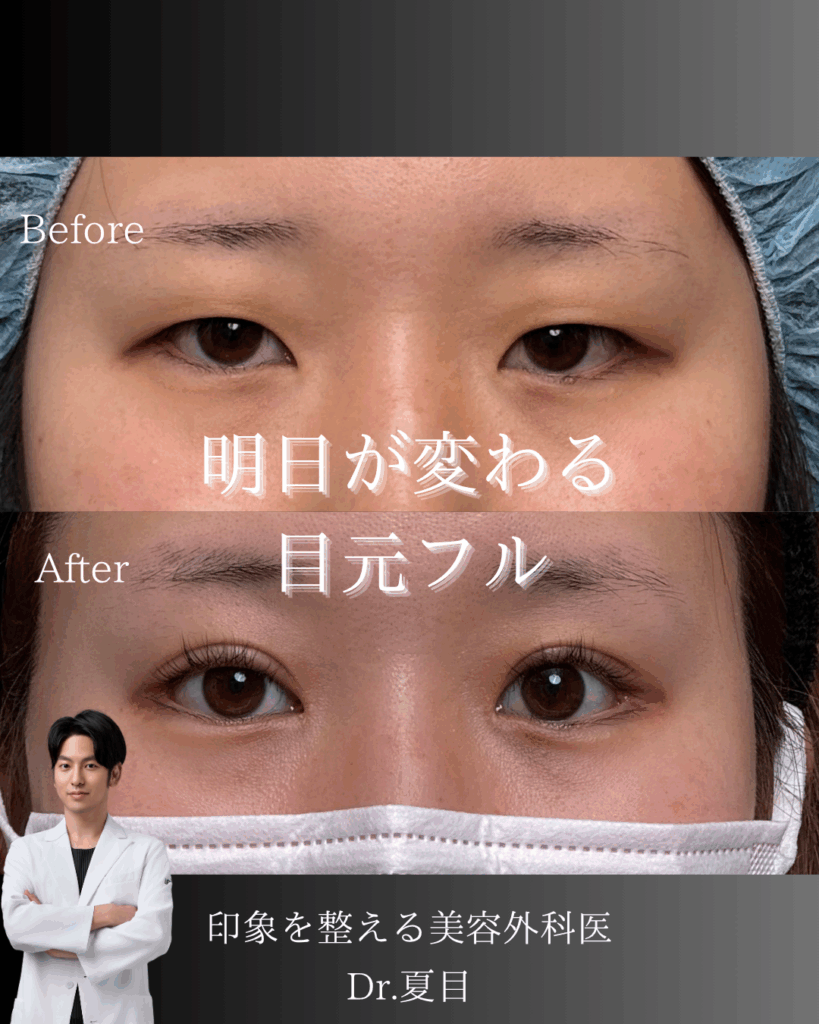 印象激変の目元フル整形