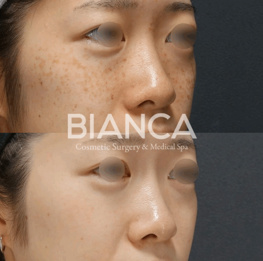 初秋に始めたい！日焼け肌をケアする美容医療とスキンケアのポイント