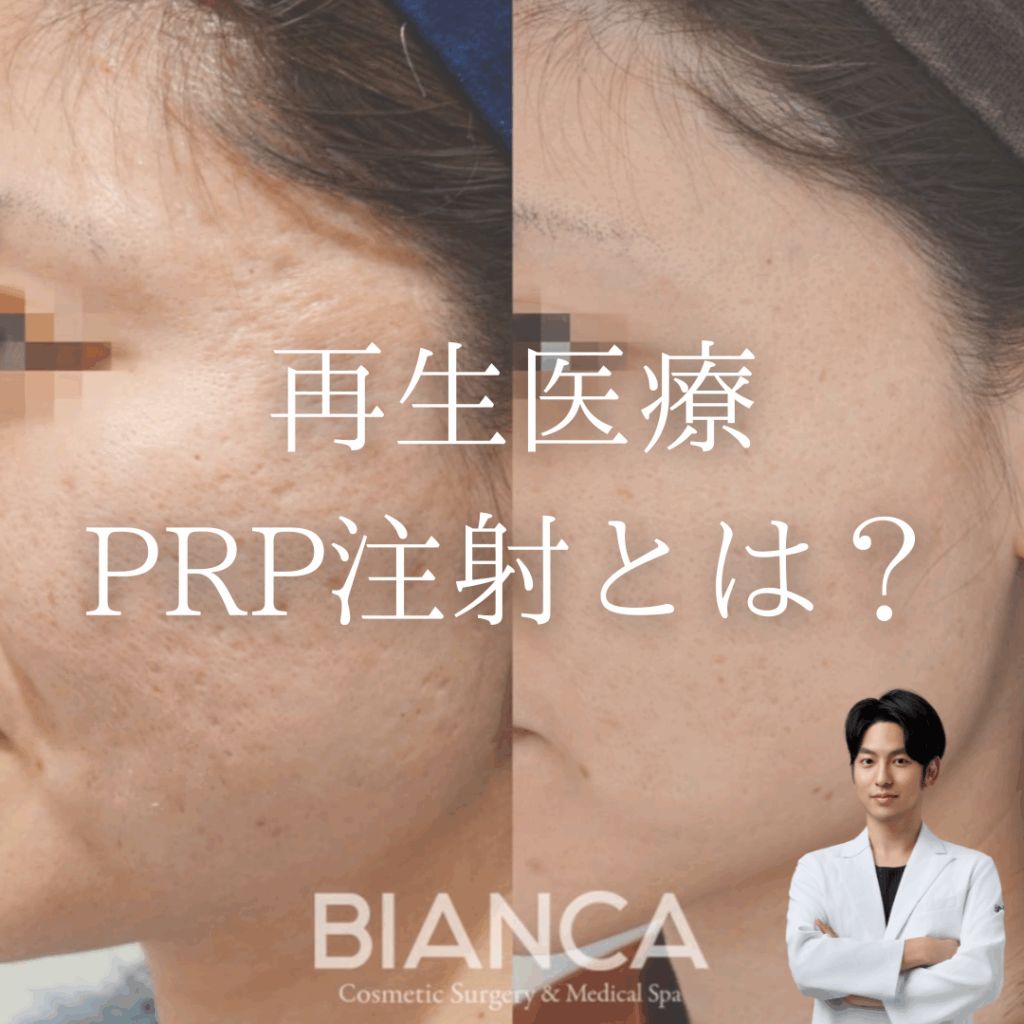 PRP注入（自己多血小板血漿注入療法）とは？