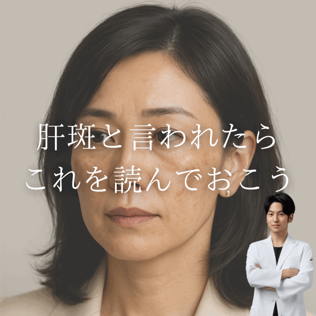 肝斑と言われたらこれを読んでおこう