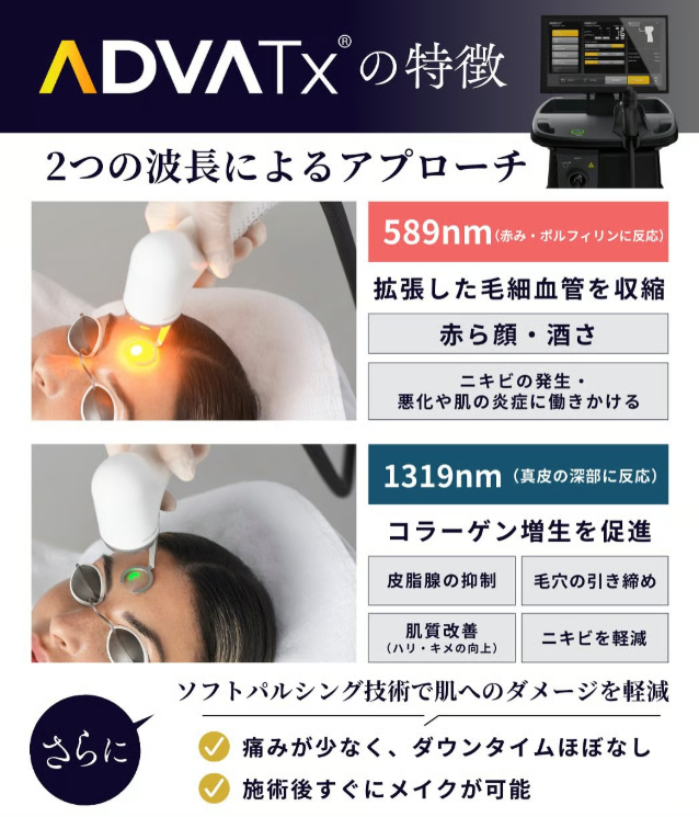 アドバテックスレーザーは赤ら顔治療の新しい選択肢