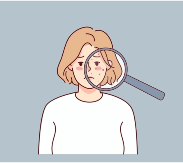 アドバテックスでニキビ跡の赤みを消す最適なタイミング