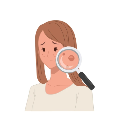 炭酸ガスレーザーとは？美容での腫瘍・病変治療に効果的