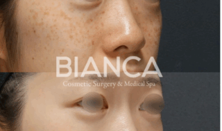 スキンケアは意味ない？美肌になるための第一歩とは｜ビアンカ銀座｜日本を代表する美容健康再生医療のクリニック