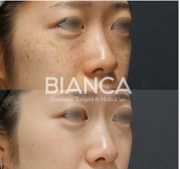 スキンケアは意味ない？美肌になるための第一歩とは。