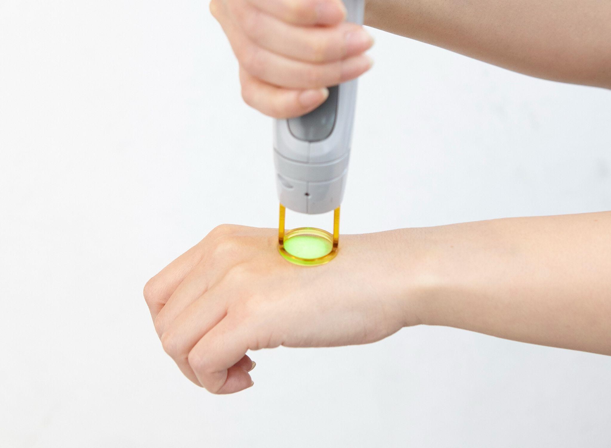 脱毛効果を左右する毛周期について