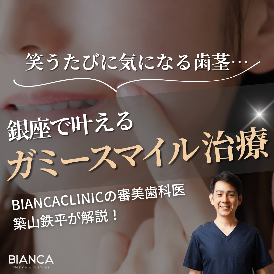 ガミースマイル