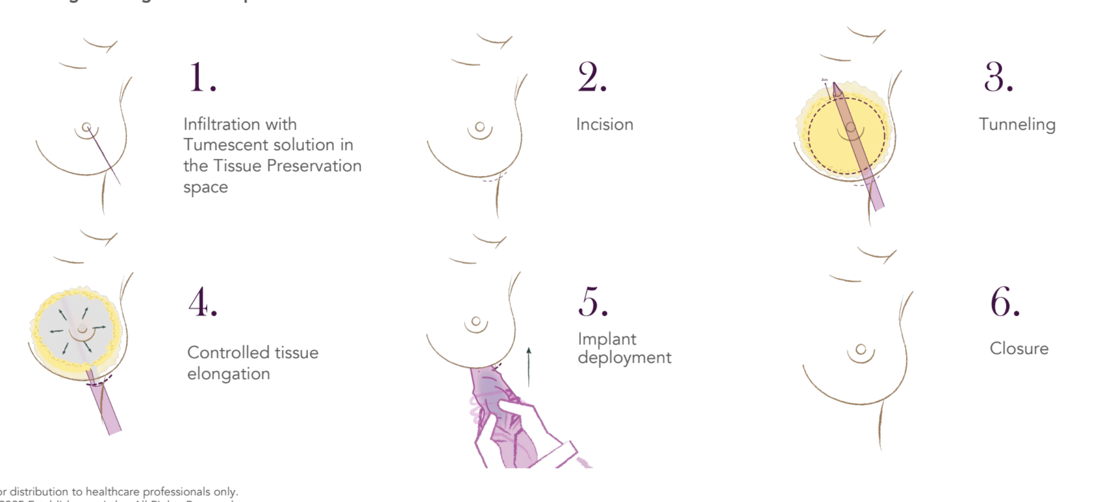 プリザベ（Preservé™）とは