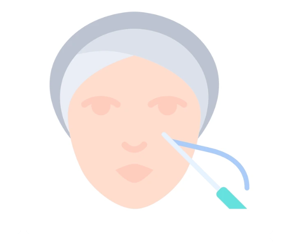 バーティカルリフトと他の糸リフトの違い