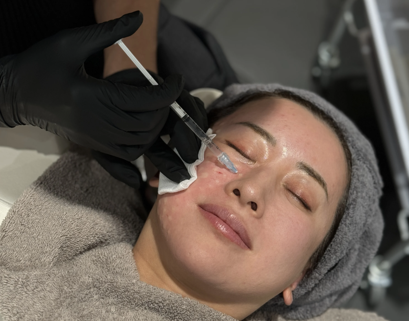 スキンブースター（肌育注射）銀座・表参道にあるBIANCA CLINIC ビアンカクリニック｜美容外科・美容皮膚科・再生医療・美容婦人科・美容内科・医療アートメイク