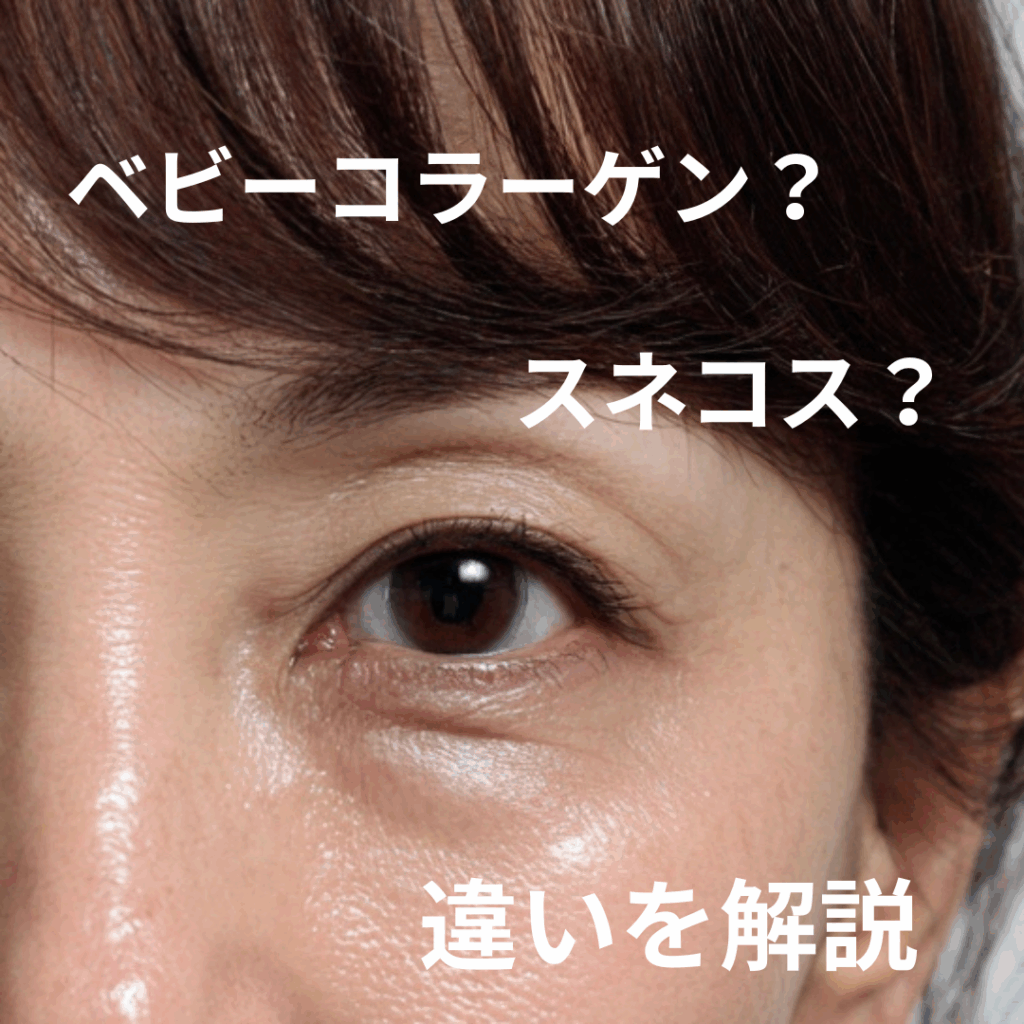 クマ治療に使われる「ベビーコラーゲン」「スネコス」──その違いと使い分け