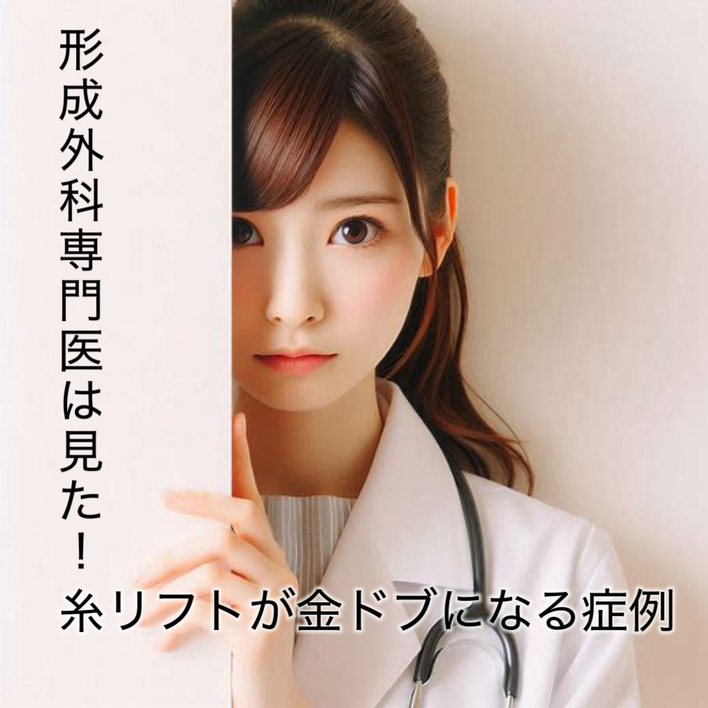 糸リフト200万円。アリ？ナシ？