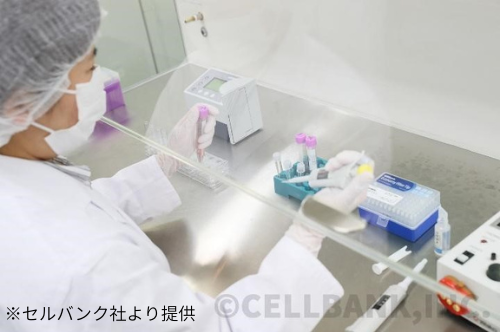 自己脂肪由来幹細胞点滴とは