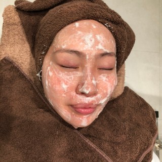 ソフトピーリングで肌に優しい<br />
