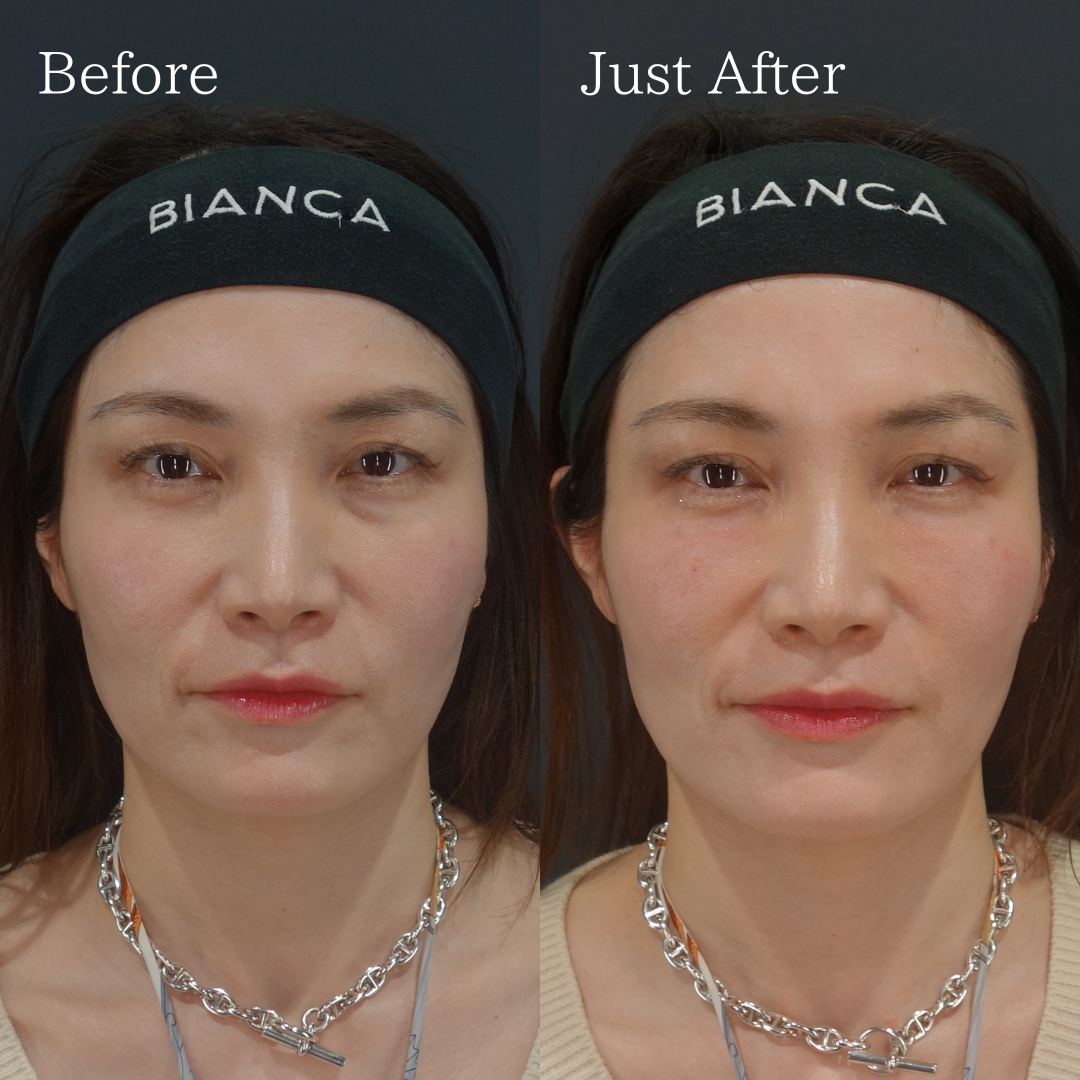 ベビーコラーゲン