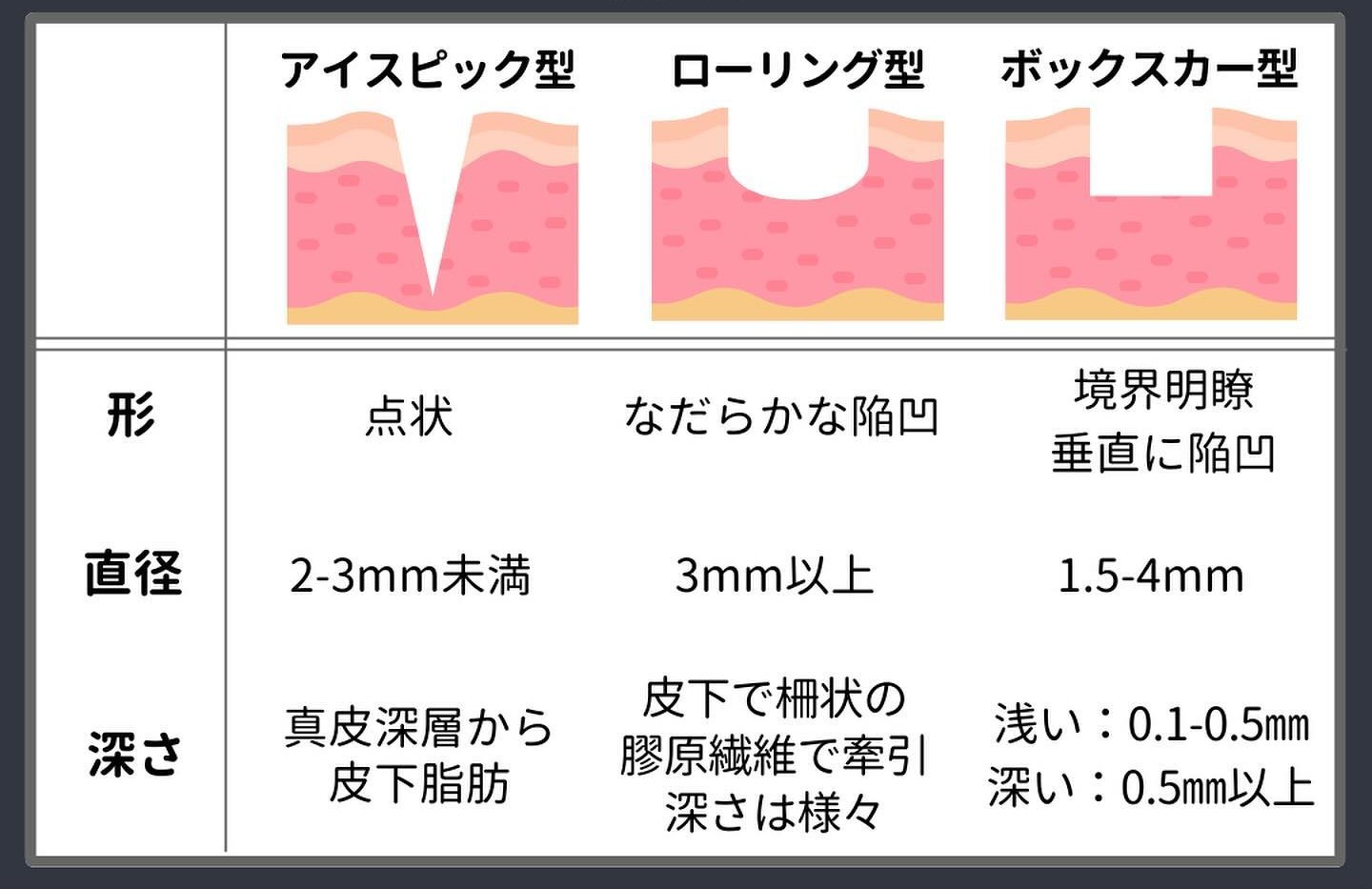 萎縮性瘢痕（クレーター）の種類