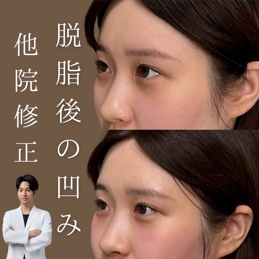 べビーコラーゲン