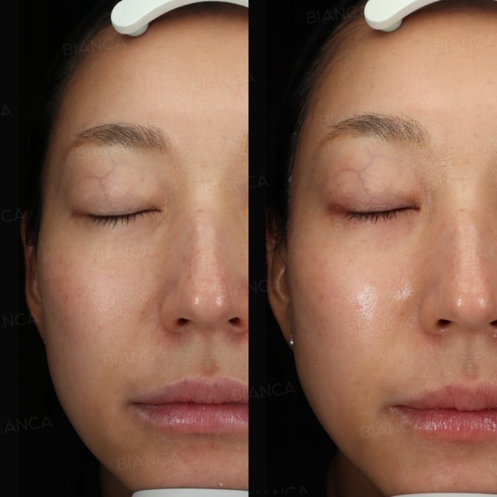 ナノステム(顔)