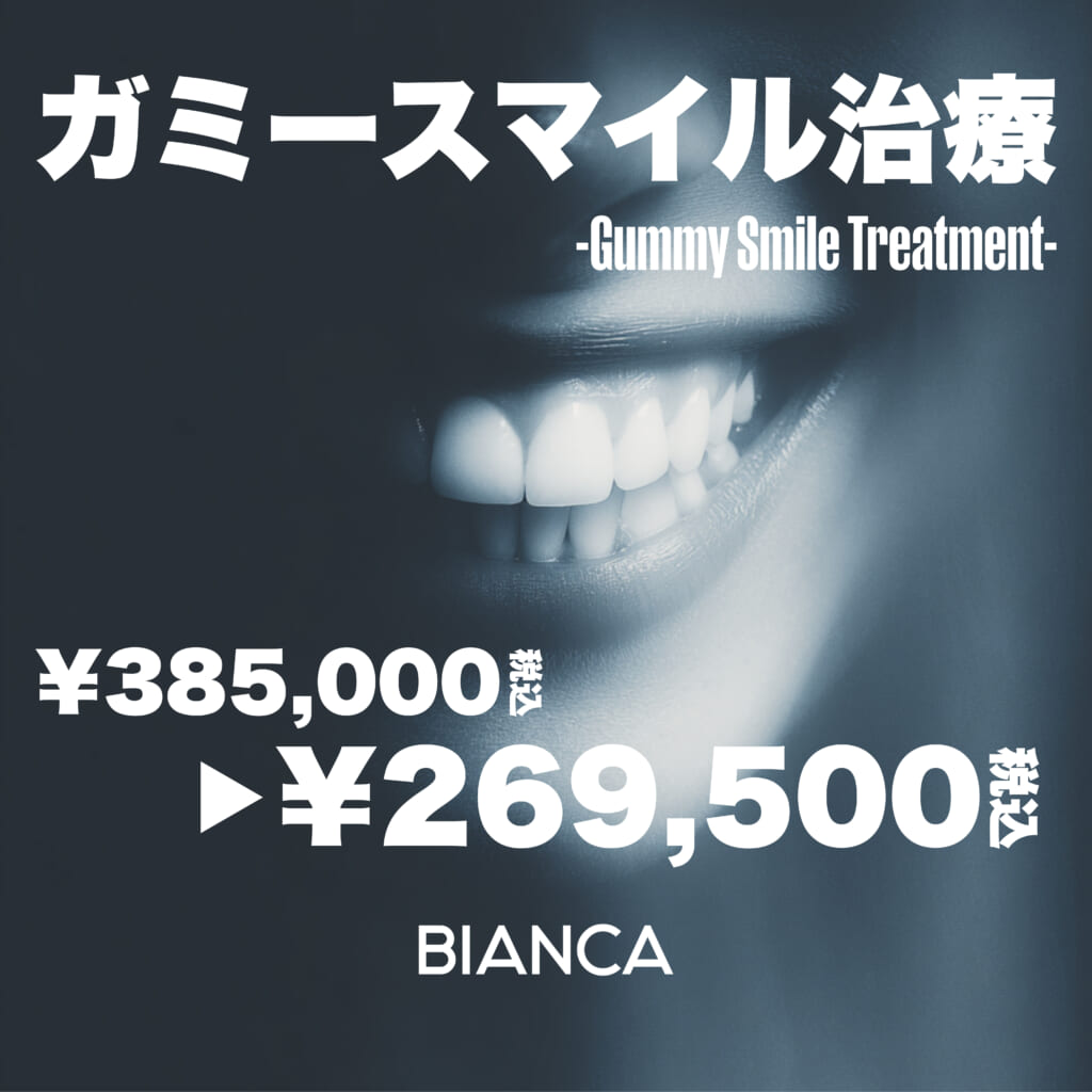【銀座限定】歯茎が見えて気になる方に「ガミースマイル治療」✨モニター特別価格👄