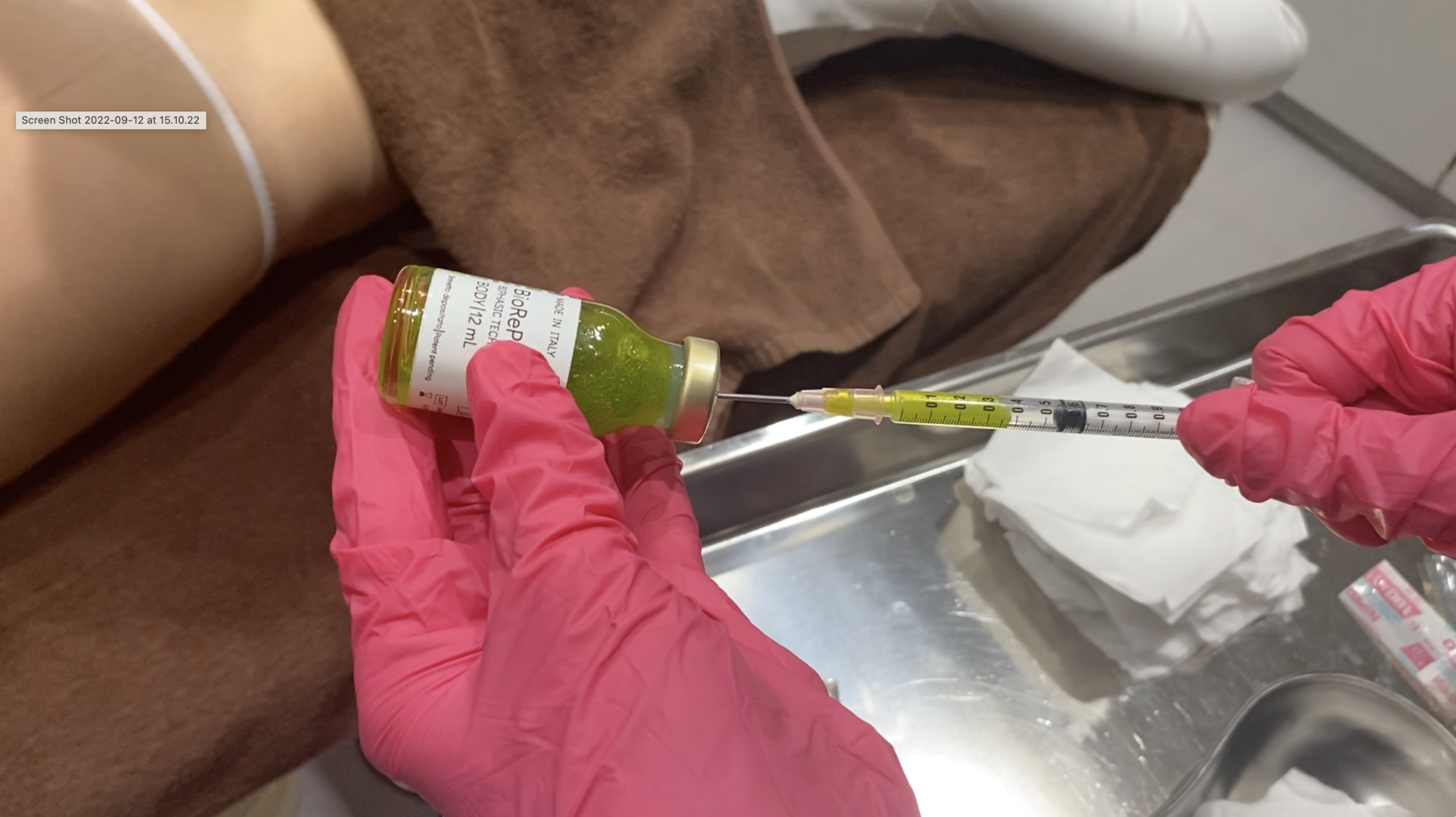 TCAによる施術時の痛みやダウンタイムに配慮<br />
