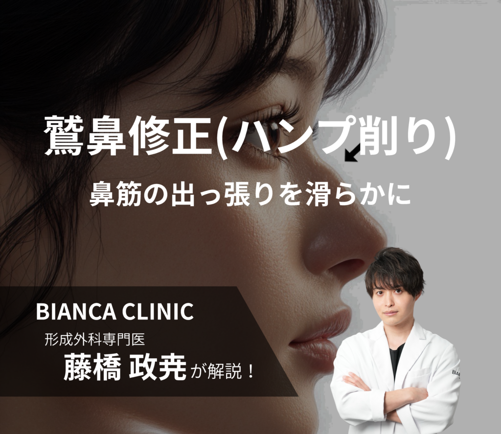 鷲鼻修正（ハンプ削り）とは？｜鼻筋の出っ張りを滑らかに