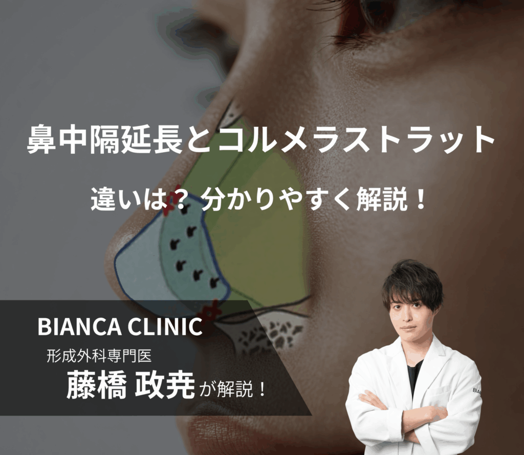 鼻中隔延長とコルメラストラットの違い｜「添える支え」と「構造の再構築」