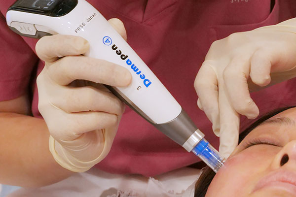 ダーマペン4 銀座・表参道にあるBIANCA CLINIC ビアンカクリニック｜美容外科・美容皮膚科・再生医療・美容婦人科・美容内科・医療アートメイク