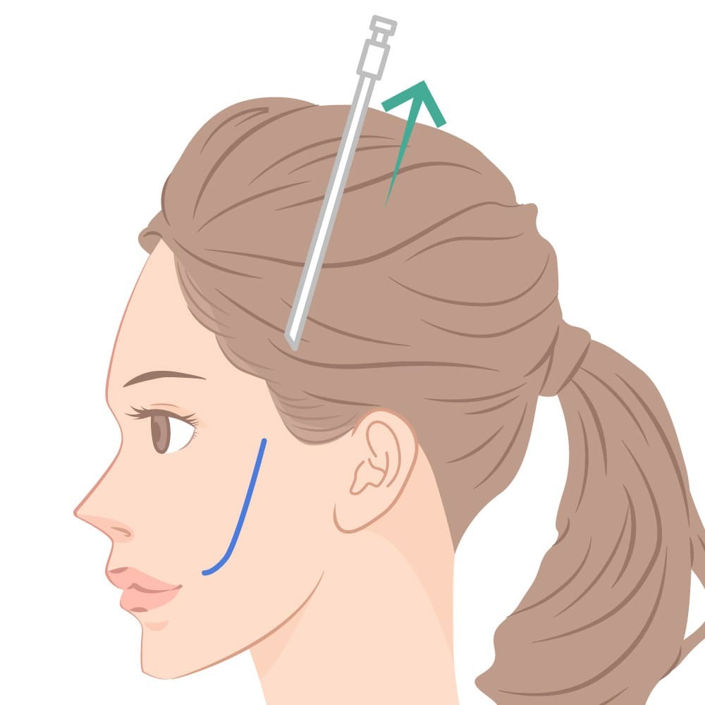 テスリフト ビアンカ銀座｜日本を代表する美容健康再生医療のクリニック