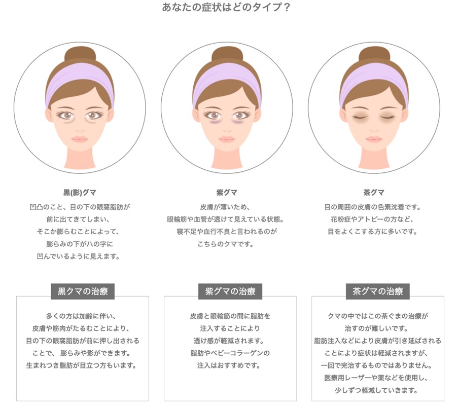 目の下クマ・たるみ取り（経結膜脱脂術）ビアンカ銀座｜日本を代表する美容健康再生医療のクリニック