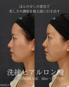 安全・強い・長持ち…全部叶えるNeauvia。|銀座・表参道にあるBIANCA CLINIC ビアンカクリニック|美容外科・美容皮膚科・再生医療・美容婦人科・美容内科
