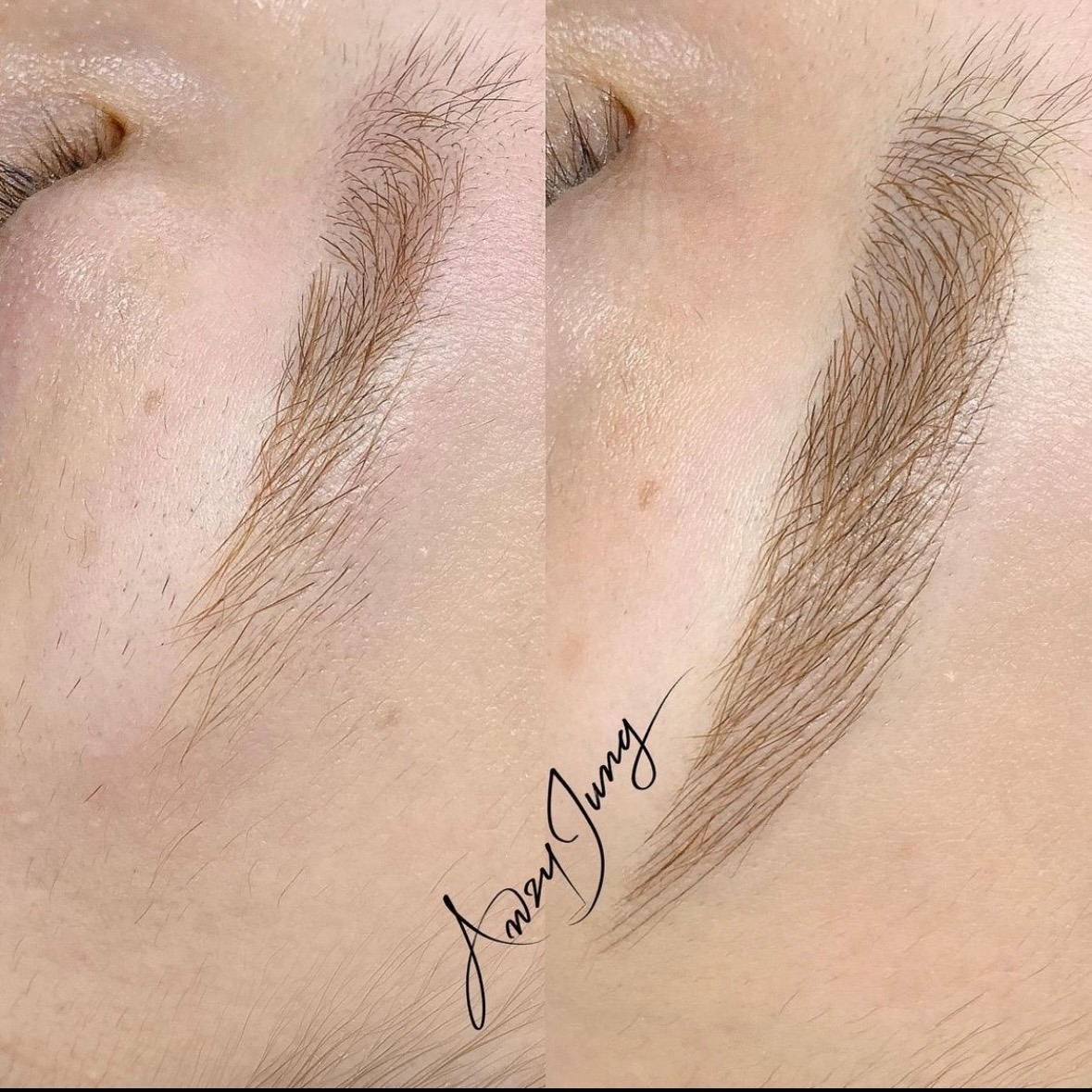 医療アートメイク