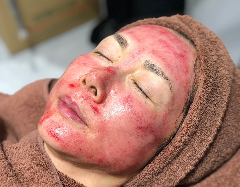 長期間にわたって効果の持続が期待できる