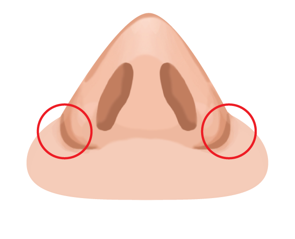 鼻翼基部プロテーゼ（貴族手術） ビアンカ銀座｜日本を代表する美容健康再生医療のクリニック