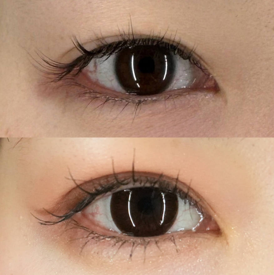 二重埋没法（裏留め）