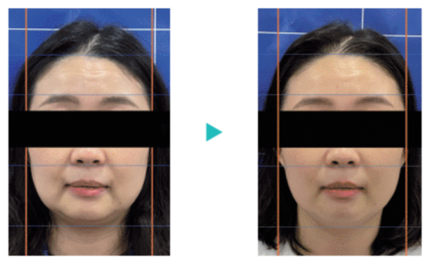 ポテンツァ（DIAMOND）