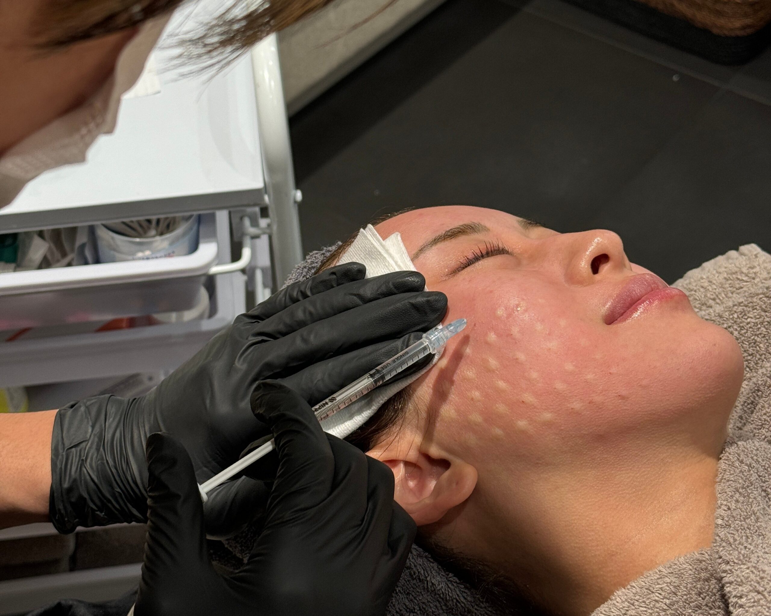 リジュランとリジュランiをお悩みに応じて使い分け