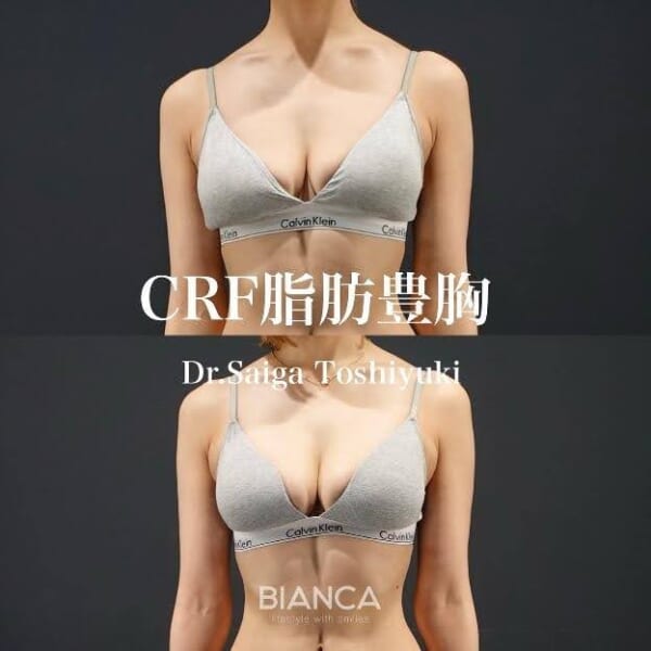 脂肪豊胸｜銀座・表参道にあるBIANCA CLINIC ビアンカクリニック｜美容外科・美容皮膚科・再生医療・美容婦人科・美容内科・医療アートメイク