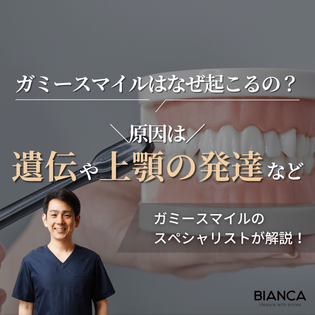 ガミースマイルはなぜ起こる？審美歯科で自然な笑顔へ｜ビアンカの審美歯科医 築山鉄平が解説！
